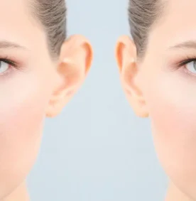 otoplasty-ear-surgery-benefits-recovery